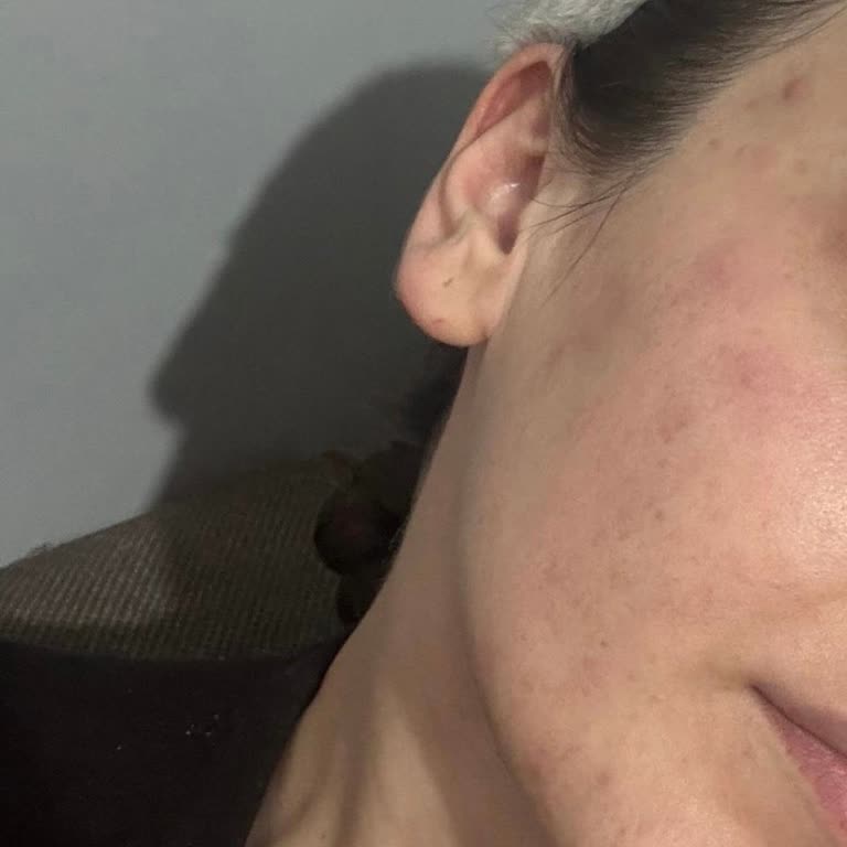 Patronun Kaba Tutumu Ve Yanıltıcı Seans Bilgisi Nedeniyle Para İadesi Talebi