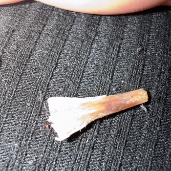 Kemiksiz Olduğu Söylenen Tavuk Göğüs Etinde Sivri Kemik Tehlikesi