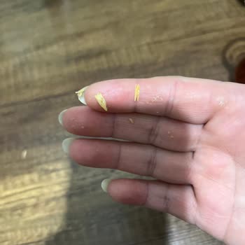 McVitie's Saklıköy Bisküvi İçinde Sert Parça Çocuğumun Damağını Yaraladı