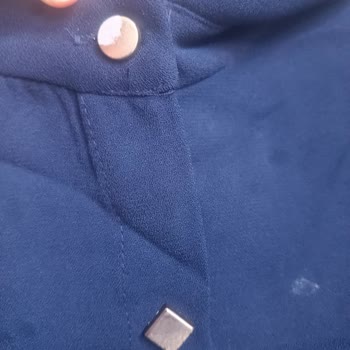 Görseldekiyle Uyuşmayan, Yıpranmış Düğmeli Ve Kötü Kokulu Tunik İçin İade Talebi