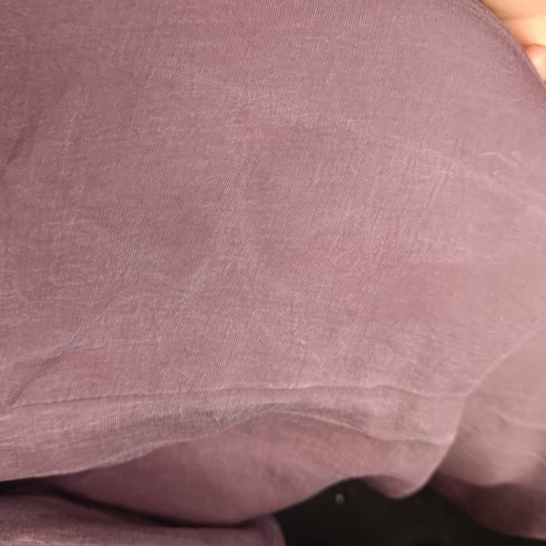 Kuru Temizleme Bilgisi Olmadan Satılan Tuniğin Yıkama Sonrası Renk Solması Ve Şirketin İade Reddi