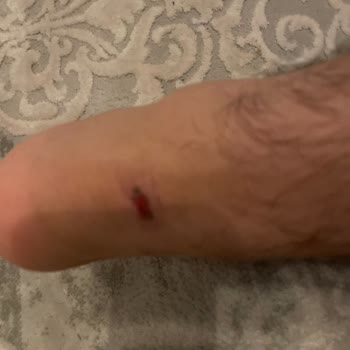 Lumberjack Ayakkabısının Topuk Saldırısı Nedeniyle Garanti Reddi