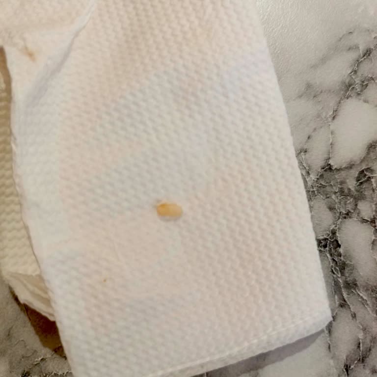 Mikrodalga İskenderde Sert Plastik Parça Ve Saygısız Personel Tutumu