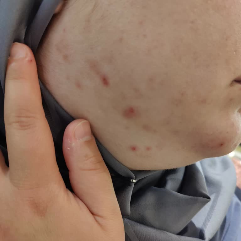 Yves Rocher Ürünlerinden Alerjik Reaksiyon Ve Mağaza Personelinin Olumsuz Tutumu