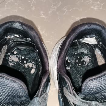 Skechers Ayakkabım Kısa Sürede Çöktü Ve Şirket Sorunu Reddetti