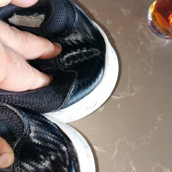 Skechers Ayakkabım Kısa Sürede Çöktü Ve Şirket Sorunu Reddetti
