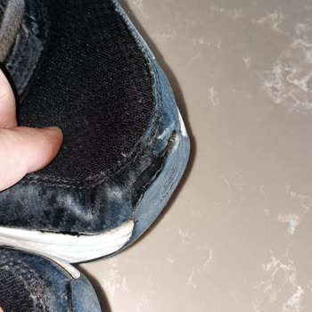 Skechers Ayakkabım Kısa Sürede Çöktü Ve Şirket Sorunu Reddetti