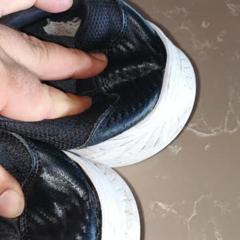 Skechers Ayakkabım Kısa Sürede Çöktü Ve Şirket Sorunu Reddetti