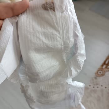 Molfix Bebek Bezinde Hijyen Sorunu: İçinden Pislik Çıktı