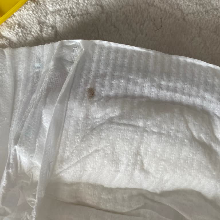 Molfix Junior Bebek Bezinde Yabancı Cisim Ve Geçersiz Kupon Sorunu