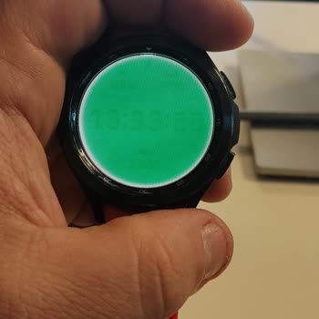 Samsung Galaxy Watch4'te Ekran Yanığı Sonrası Pil Ömrü Çöküşü Ve Haksız Servis Ücretleri