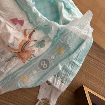 Prima Aktif Bebek Bezinin Cırt Kısmının Dayanıksızlığı Dolayısıyla Para İadesi Talebi
