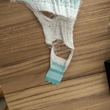 Prima Aktif Bebek Bezinin Cırt Kısmının Dayanıksızlığı Dolayısıyla Para İadesi Talebi