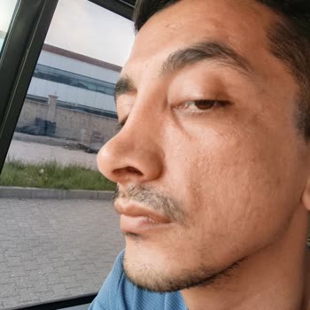 Burun Estetiği Sonrası Şiddetli Komplikasyon Ve Ücretsiz Revizyon Sözünün İhlali