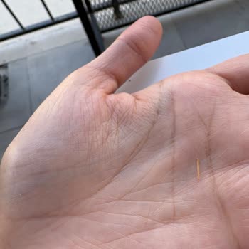 Manisa 45 Park Şubesinde Köfte İçinden Çıkan Kıymık Dişime Batti Sağlık Ve Hijyen Sorunu
