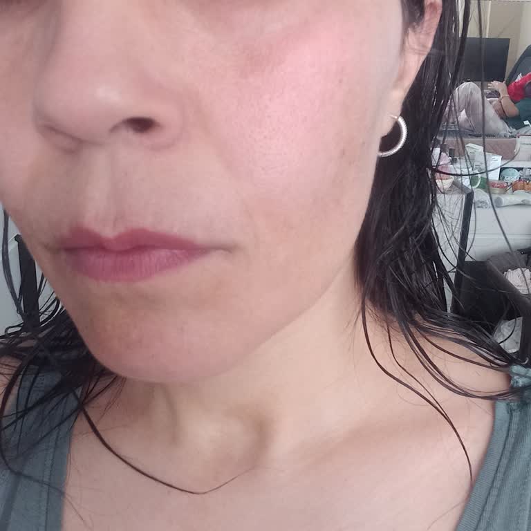 Neutrogena Peeling Jelinde İlk Kullanımda Şiddetli Yanma Ve Kızarıklık Şikayeti