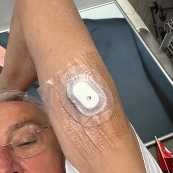 Sibionics Sensör Bandı Açıldı, Suya Dayanıklılık Sorunu Ve Sensör Değişimi Talebi