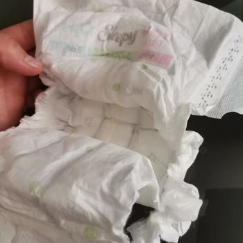 Sleepy 5 Numaralı Bebek Bezlerinde Yan Tarafların Sürekli Yırtılması Ve İade Talebi