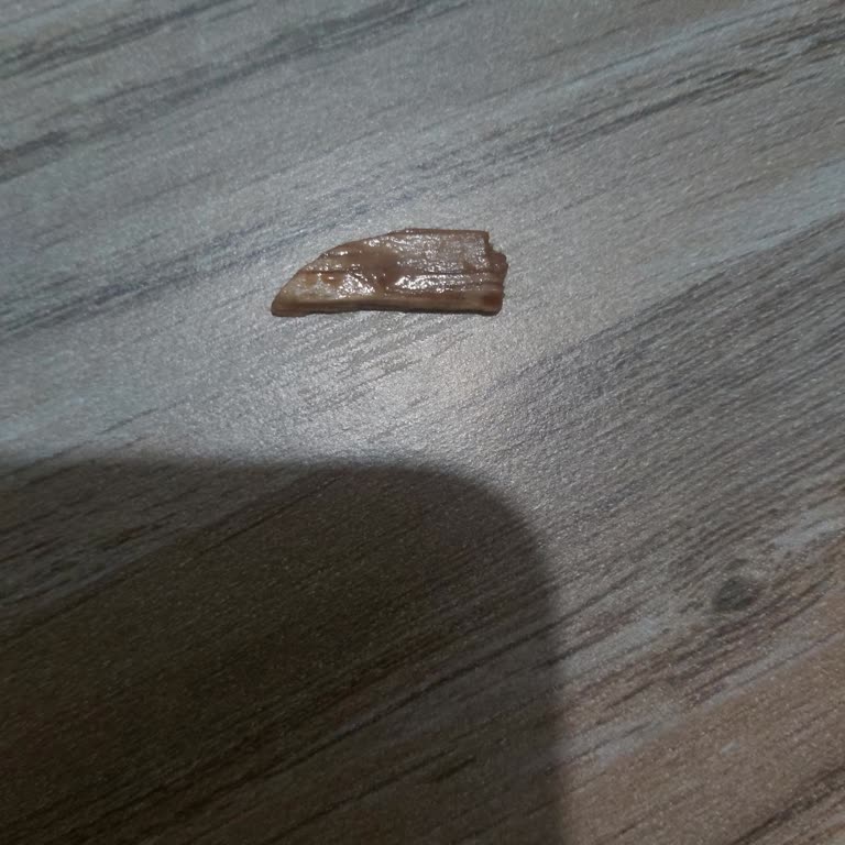 Magnum Mini Badem Dondurmasında Tahta Parçası Neredeyse Dişimi Kırdı Ve Şirket Geri Dönüş Yapmadı