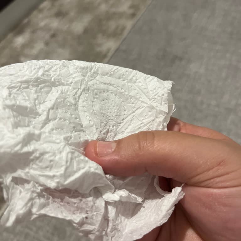 Kahve Dünyası Çikolatasında Saç Tespiti Ve Hijyen Şikayeti