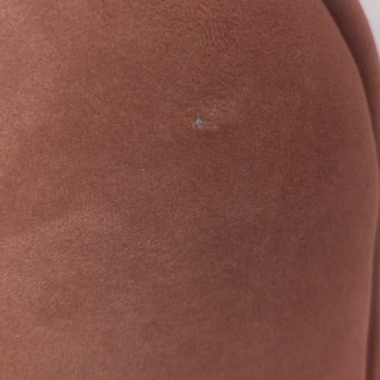Üretim Hatası Nedeniyle Koltuk Takımının Değişimini İstiyorum
