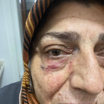 İkra Giyim Kusurlu Abiye Ve Mağaza Çalışanlarının Şiddetli Davranışı