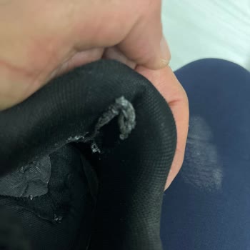Adidas Ayakkabılar 4 Ayda İçleri Parçalandı, Garanti Kapsamı Reddedildi