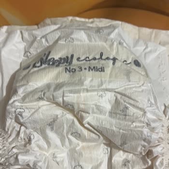 Migros’ta Satın Alınan Sleepy Bebek Bezinde Alerji Ve Kabarma Sorunu
