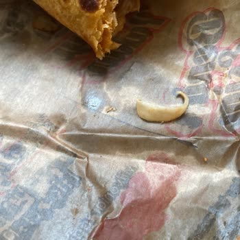 Döner İçinden Çıkan Hijyenik Olmayan Şey Ve İade Talebi