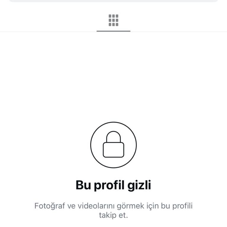 Mikro Kaynak Atölyesi’nde Söz Verilen 70 cm Saç Uzunluğu Gerçekleşmedi Ve Şikayette Engellendi