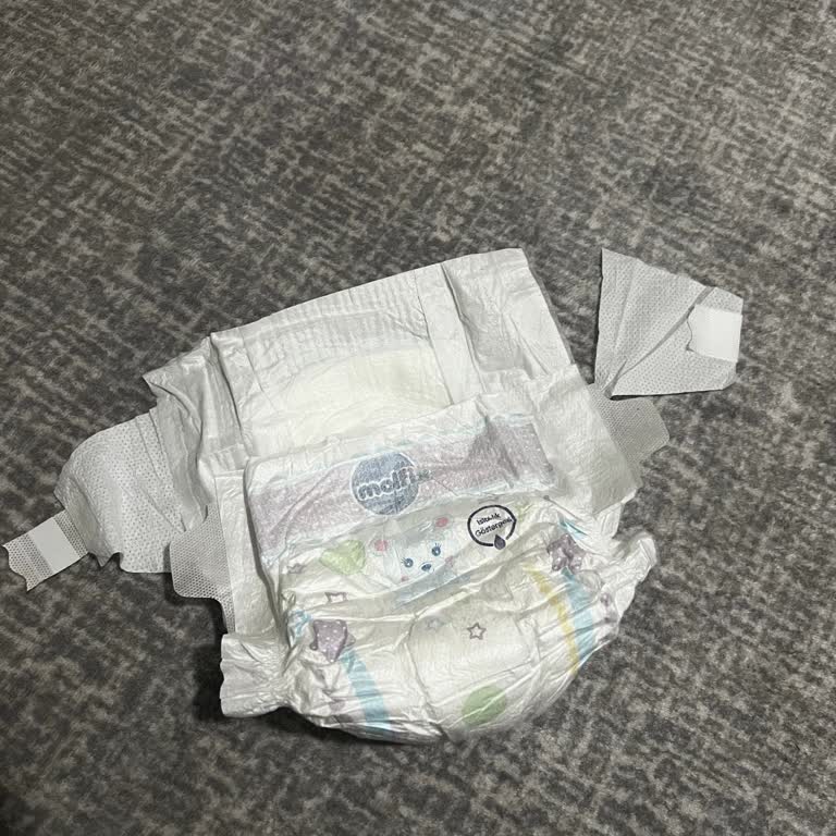 Molfix Bebek Bezlerinde Çırt Kısmı Yırtık Sorunu Tekrarlıyor