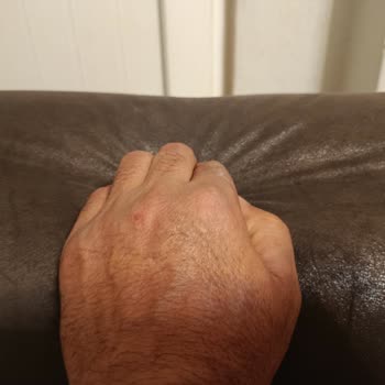 Nizamlar Mağazasındaki Koltuk Takımının Hızlı Deforme Olması Ve Servis Cevapsızlığı