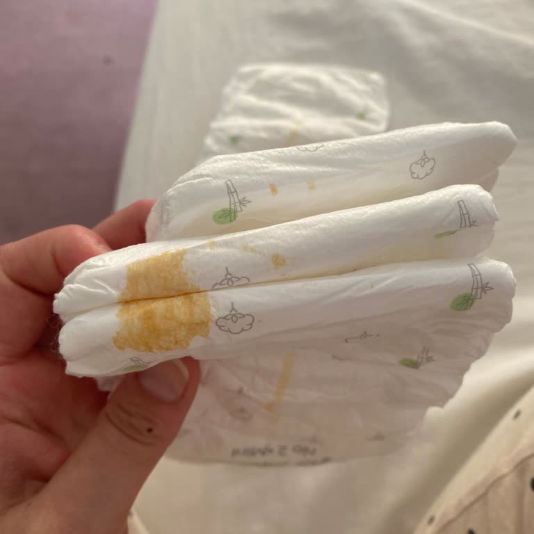 Sleepy Natural Bebek Bezlerinde Lekeler Ve Kimyasal Koku Nedeniyle Değişim Talebi