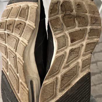Skechers Ayakkabısının Tabanda 6 Ayda Dökülmesi Ve Boyner’in Kullanıcı Hatası İddiası
