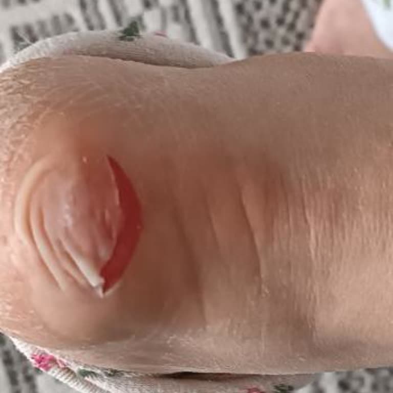 Garanti Reddi Sonrası Ayağımı Vuran Ayakkabı Değişim Talebi