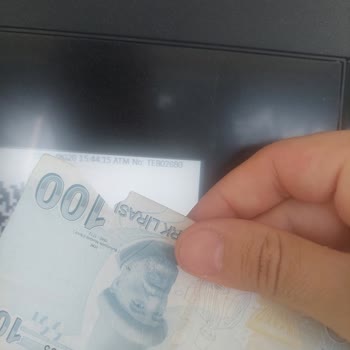 ATM’den Yırtık Banknot İadesi Ve Müşteri Hizmetinin Ciddiyetsiz Tavsiyesi