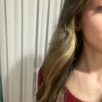 Saç Boyama Sonrası Ağır Yanma, Kırılma Ve Renk Eşitsizliği, İade Talebi