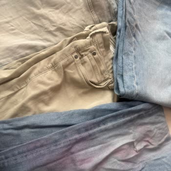 Mavi Çocuk Şortunun Renk Aşması Diğer Kıyafetlerimi Mahvetti, Talebim Reddedildi