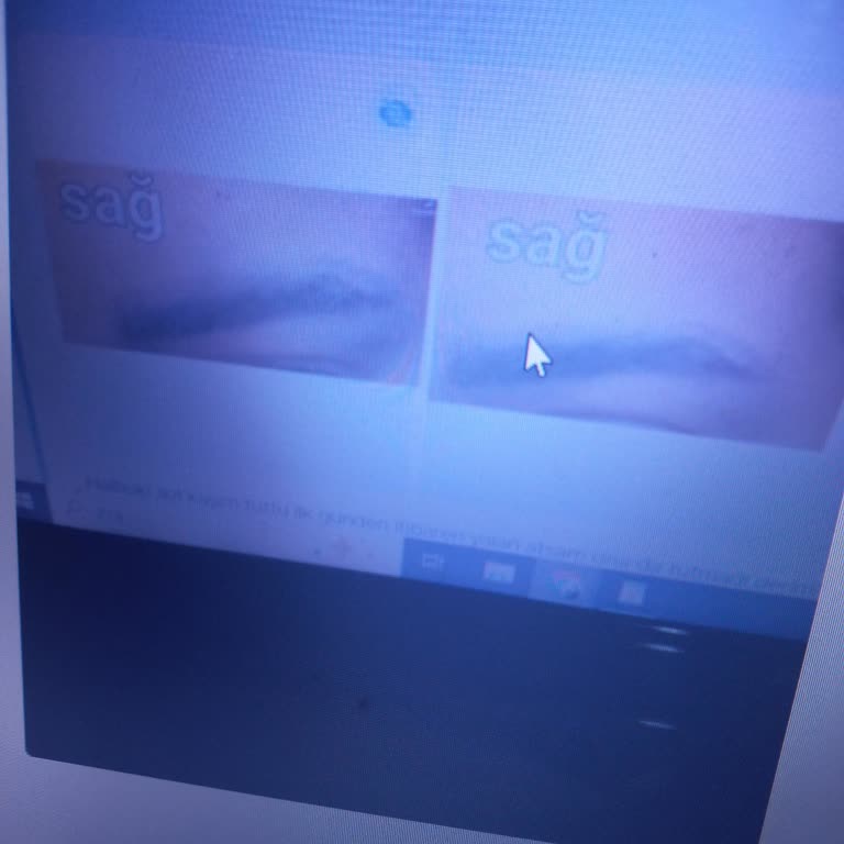Microblading Sonrası Kaş Tutmaması Ve Saygısız Servis