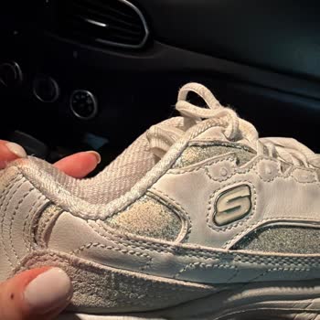Simleri Kısa Sürede Dökülen Skechers Ayakkabısının Üretici Hatası İade Reddi