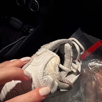 Simleri Kısa Sürede Dökülen Skechers Ayakkabısının Üretici Hatası İade Reddi