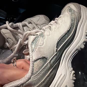 Simleri Kısa Sürede Dökülen Skechers Ayakkabısının Üretici Hatası İade Reddi