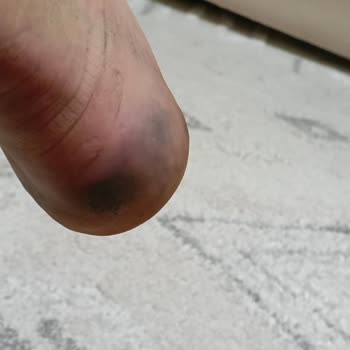 Renk Atan Deri Ayakkabı Özel Günümde Çoraplarımı Kararttı Ve İade Talebim