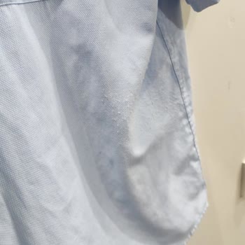 Mavi Gömleğin Yıkama Sonrası Pamuk Kabarması Ve İade Talebi