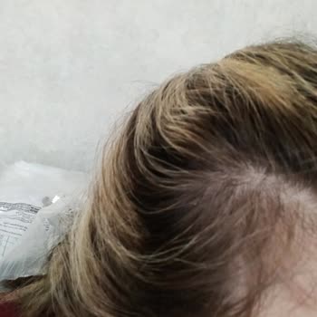 Ombre İşleminde Renk Uyumsuzluğu Ve Tam İade Talebi