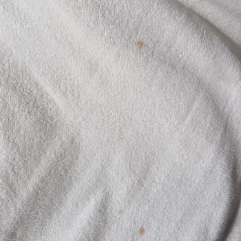 Arçelik Çamaşır Makinesindeki Pas Lekeleri Ve Tekrarlayan Arızalar Nedeniyle Acil Değişim Talebi