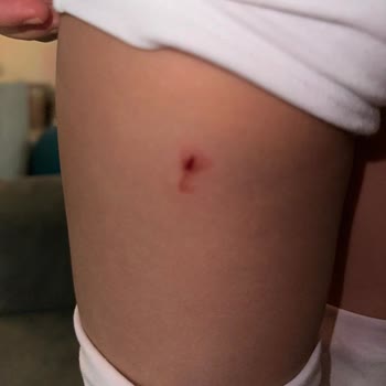 Çocuk Oyun Alanında Kesik: Gazi Seyir Café'de Güvenlik İhmali Ve Resmi Yaptırım Talebi