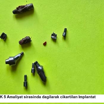 Sanita Sağlık Grubu Hem Sağlık Hem Psikolojik Hem De Maddi Olarak Büyük Bir Yıkım Yaşadım
