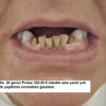 Sanita Sağlık Grubu Hem Sağlık Hem Psikolojik Hem De Maddi Olarak Büyük Bir Yıkım Yaşadım