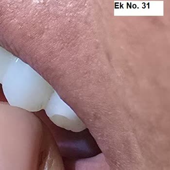 Sanita Sağlık Grubu Hem Sağlık Hem Psikolojik Hem De Maddi Olarak Büyük Bir Yıkım Yaşadım